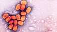 Isorokko on vaarallinen tartuntatauti, jonka aiheuttaa variola-niminen virus. Tauti nujerrettiin rokotuksilla, mutta virusta tutkitaan yhä laboratorioissa.