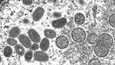 Mikroskooppikuvassa näkyy soikeita apinarokkoviruksen partikkeleita. Kuva on otettu ihmisen ihonäytteestä.
