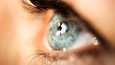 Niistä joille silmän lasiaisen irtauma aiheuttaa oireita, noin 5–10 prosentille tulee verkkokalvoon pieni reikä, jonka silmälääkäri voi korjata.
