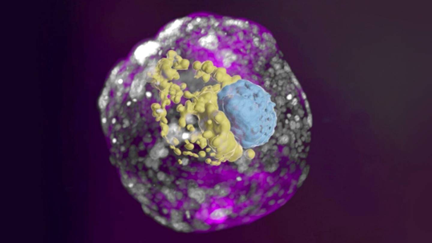 Kantasolut | Tutkijat kasvattivat ihmisalkiota jäljittelevän mallin – eikä siihen tarvittu spermaa tai munasolua
