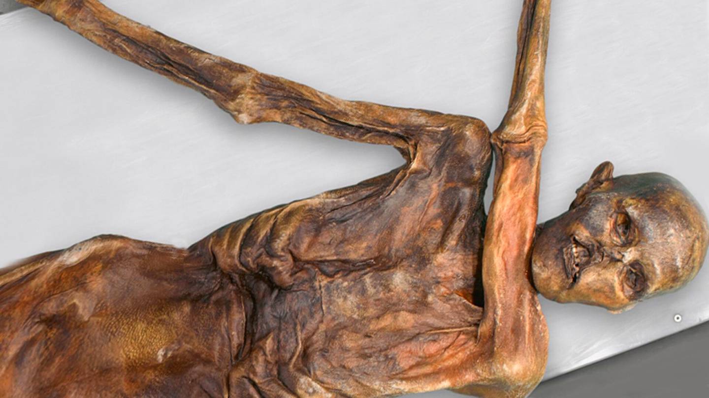 Dna | Jäämies Ötzi oli luultua tumma­ihoisempi ja yllättävää syntyperää