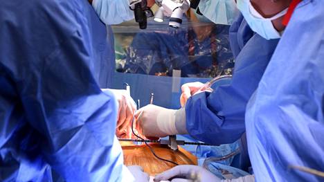Marylandin yliopiston sairaalan kirurgit siirsivät sian sydämen miehelle vuoden alussa. 