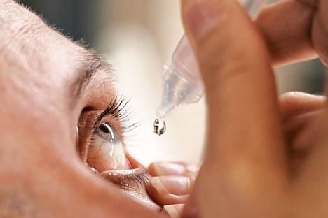Kuivasilmäisyyden hoitoon käytetään silmätippoja, joita on lisättävä useita kertoja päivässä. 
