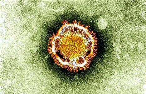 Koronavirus elektronimikroskoopilla nähtynä.