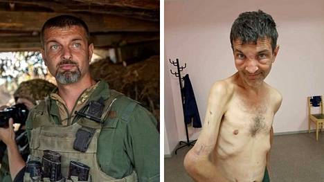 Ukrainalainen merijalkaväen sotilas Myhailo Djanov vapautui riutuneena Venäjän sotavankeudesta keskiviikkona. Vasemmanpuoleisessa kuvassa Djanov ennen vankeutta ja oikeanpuoleisessa kuvassa vankeuden jälkeen.