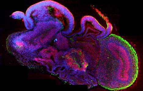 Miniaivoista on paljon hyötyä erilaisten aivosairauksien tutkimuksessa. Kuvassa on kasvatettua aivokudosta.