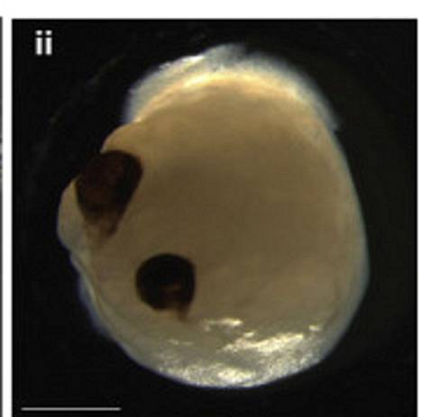 Kuvassa on 60 päivän ikäinen aivo-organoidi. Optiset kupit näkyvät tummina kasvustoina. Kuva on tutkimuksesta.