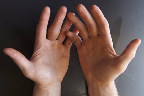 The hands of wrestler Rami Hietaniemi were photographed in 2014.