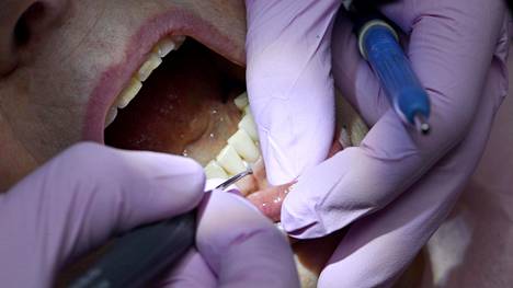 Pääkirjoitus | Koronaviruskriisin jälkeen kärsitään risoista hampaista ja liian myöhään huomatuista sairauksista