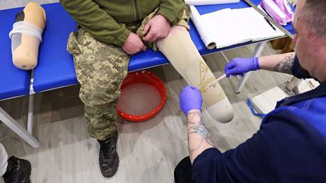 HS oli paikalla, kun kiovalaisella proteesiklinikalla valettiin muottia jalkansa menettäneen sotilaan proteesituelle.