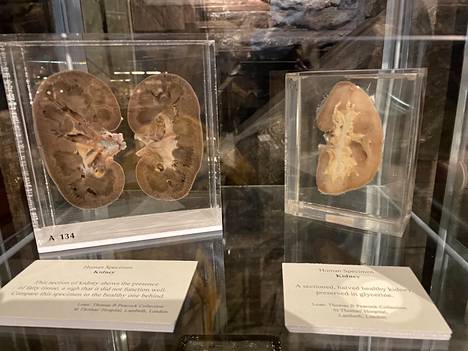 Kidneys from the museum's collection.