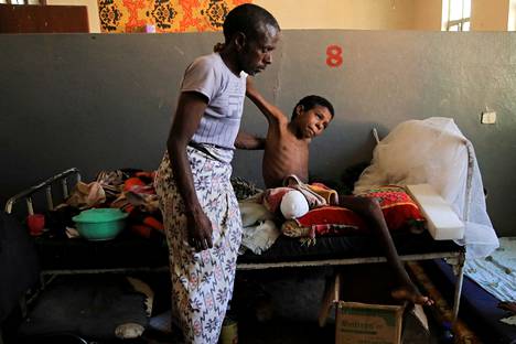 Ali Asyalo, 14, sai hoitoa menetettyään jalkansa kranaattiräjähdyksessä Etiopian armeijan ja Tigrayn joukkojen välisissä taisteluissa Afarin alueella Etiopiassa helmikuussa 2022. 