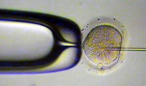 Siittiöitä työnnetään neulassa munasoluun hedelmöityshoidon yhteydessä.