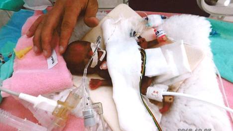 Maailman pienin poikavauva pääsee sairaalasta yli puolen vuoden jälkeen kotiin Japanissa