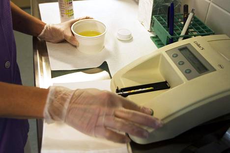 Diacorin laboratoriossa Helsingissä analysoitiin virtsanäytteitä kesällä 2008.