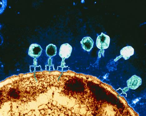 Faagit käyvät joukolla Escherichia coli -bakteerin kimppuun väritetyssä läpäisyelektronimikroskoopin kuvassa.