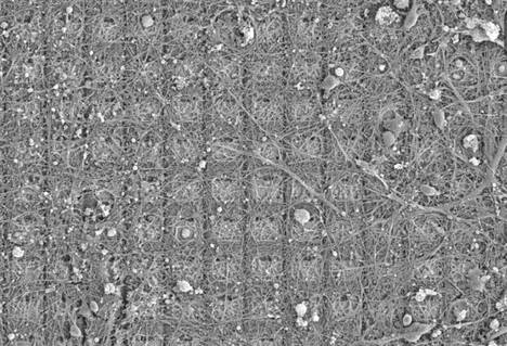 Tunneloivan elektronimikroskoopin kuva viljelmästä, jossa hermosolut kasvoivat piirilevyn päällä kuuden kuukauden ajan. 