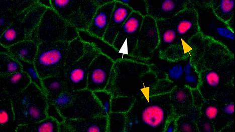 Maksasoluissa on eri määriä dna:ta. Useimmissa on kaksi kopioita dna:sta, kuten valkealla nuolella merkityissä soluissa. Kuvan keltaisilla nuolilla merkattuihin soluihin on kasautunut enemmän dna:ta. Eri solutyypit uusiutuvat eri vauhtia. Kuva on tutkimuksesta.