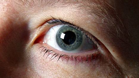 Tutkijat yrittävät parantaa sokeuden muokkaamalla silmän geenejä