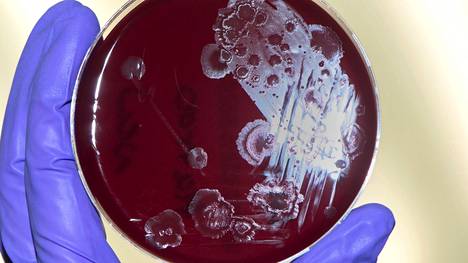 Elatusmaljalla kasvaa Clostridium difficile -bakteereja. Ne aiheuttavat vakavia tulehduksia ja ovat kehittäneet antibiooteille vastustuskykyisiä kantoja. Niitä on onnistuttu nitistämään ulosteensiirroilla.