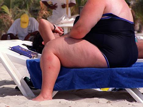 Liikunnalla ei voi kumota lihavuuden mukanaan tuomia terveyshaittoja, tuoreessa suomalaistutkimuksessa esitetään.