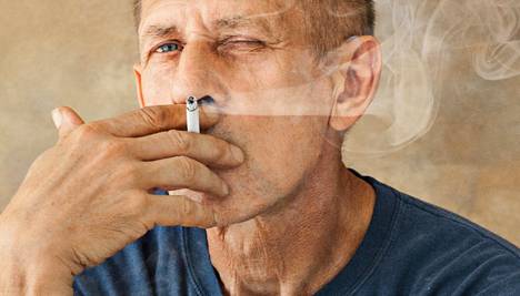 Paljon ryppyjä ikävuosiin nähden? Se voi johtua paitsi tupakoinnista myös elimistön oireilusta. 