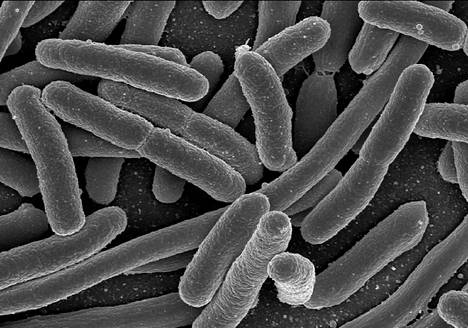 Proteobakteereihin kuuluvia Escherichia coli -bakteereja.