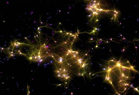 Mikroskoopin kuva Dishbrain-viljelmästä. Kuvassa on värjättynä hermosoluja ja niiden osia.