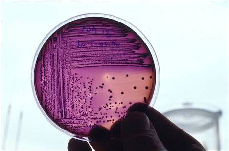 Mikrobit ovat tärkeitä ihmisille, eivät vain taudinaiheuttajia.