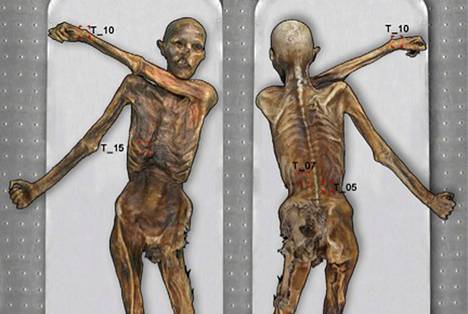 Jäämuumio Ötzin tatuoinneissa on yleensä vaaka- tai pystysuoria viivoja.