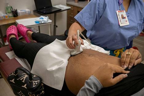 Lääkäri tekee ultraäänitutkimusta ennen kirurgista raskaudenkeskeytystä Austinista Texasista saapuneelle asiakkaalle klinikalla Oklahomassa joulukuussa 2021.