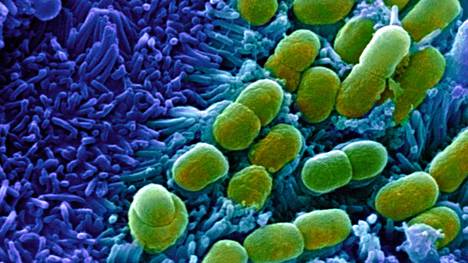 Tiede | Oppiva tekoäly löysi uuden tehokkaan antibiootin