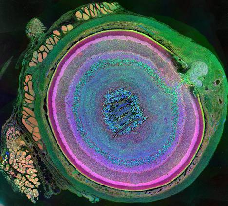Nisäkkään monimutkaisesti rakentuvassa silmässä on useita solutyyppejä, kuten väritetty kuva hiiren silmästä osoittaa.