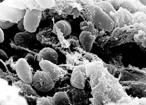 Yersinia pestis -bakteereja Yhdysvaltalaisessa laboratoriossa kuvattuna.