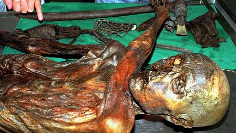 Jäämies Ötzi kuoli täysin vatsoin, mutta nykyihmistä hänen viimeinen ateriansa voi hirvittää