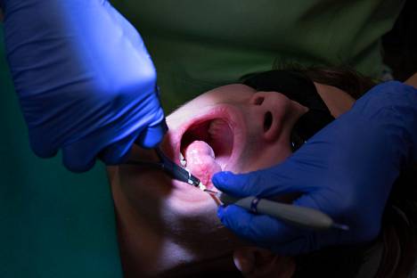 Moni jättää hammaslääkärikäynnin väliin, koska hampaiden huono kunto ahdistaa.