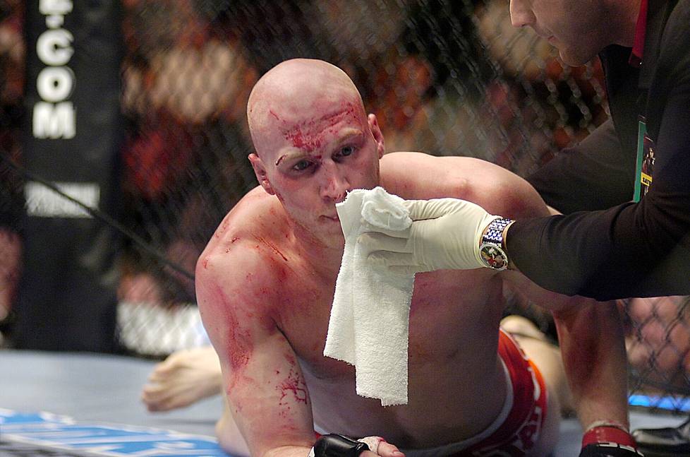 Nick Thompson tyrmättiin usein harjoituksissa – ja joskus itse otteluissakin. Thompson kuvattiin häviämänsä UFC-ottelun päätteeksi Californiassa vuonna 2006.