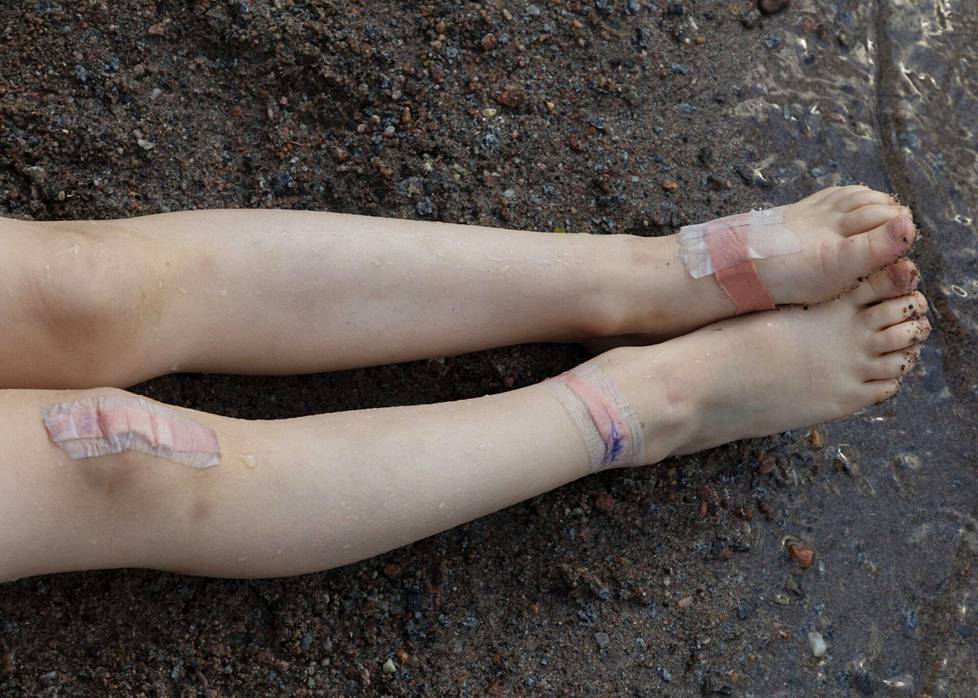 Kesän 2021 leikeissä tuli usein naarmuja jalkoihin. Laastarit auttavat haavoihin.