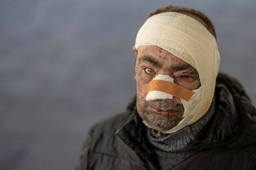 Päähän haavoittunut ukrainalainen Viktor kuvattiin Kiovan lähistöllä sijaitsevan Brovaryin sairaalan edustalla lauantaina.