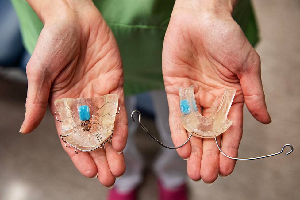 Hammaslääkäri Heidi Arposen käsissä on kaksi oikomiskojetta, joiden sisällä on lämpöön reagoivat mikrosirut. Niiden avulla hän seurasi tutkimuksessaan oikomiskojeiden käyttöä.