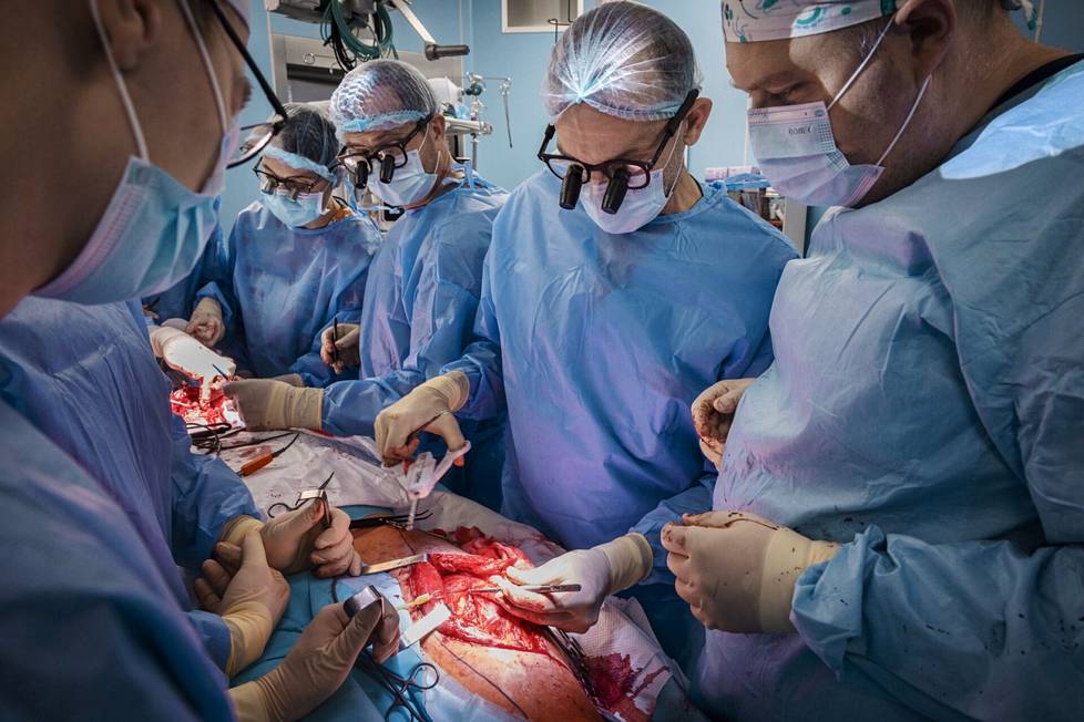 Suomalaiset kirurgit Johanna Snäll, Tommy Wilkman, Karri Mesimäki sekä ukrainalainen kollega Juri Tšepurnyi (oik.) leikkasivat potilasta kiovalaisessa sairaalassa lokakuun alussa.