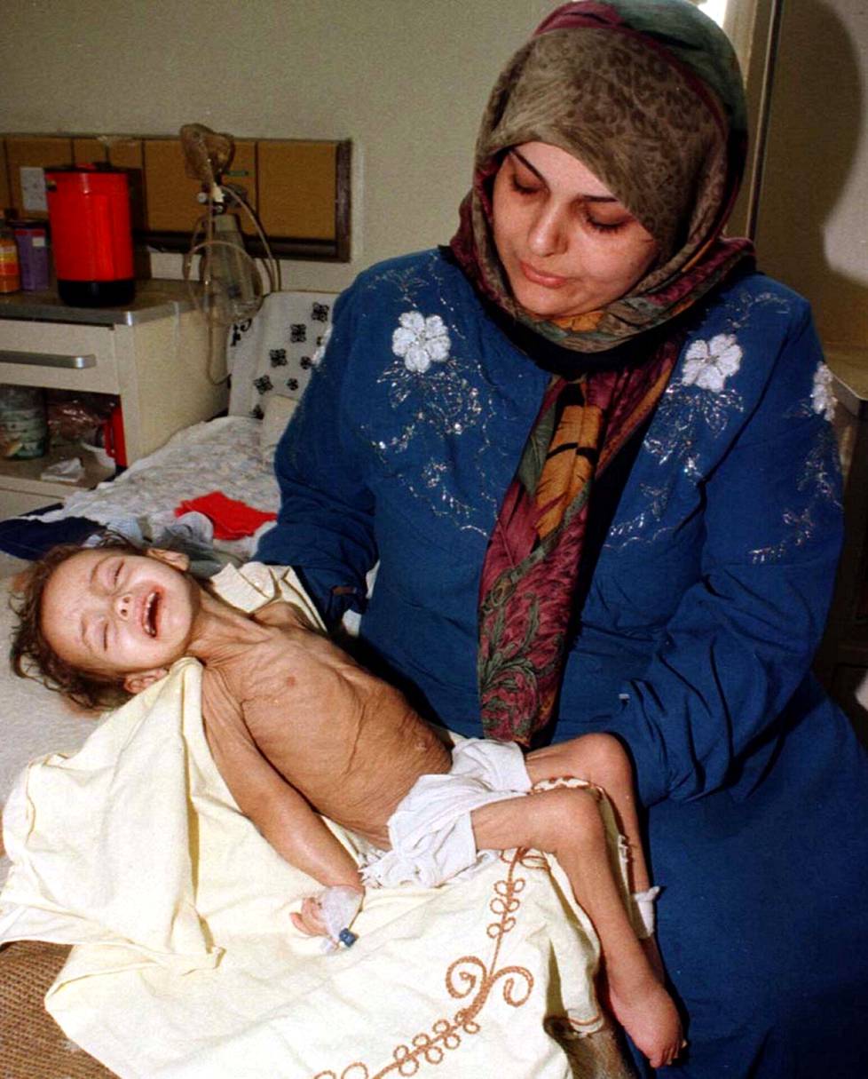 Irakilaisnainen piteli aliravittua lastaan sairaalassa Bagdadissa vuonna 1998. Yli vuosikymmenen voimassa olleet Irakin-vastaiset pakotteet kurittivat tavallisia kansalaisia pahoin.