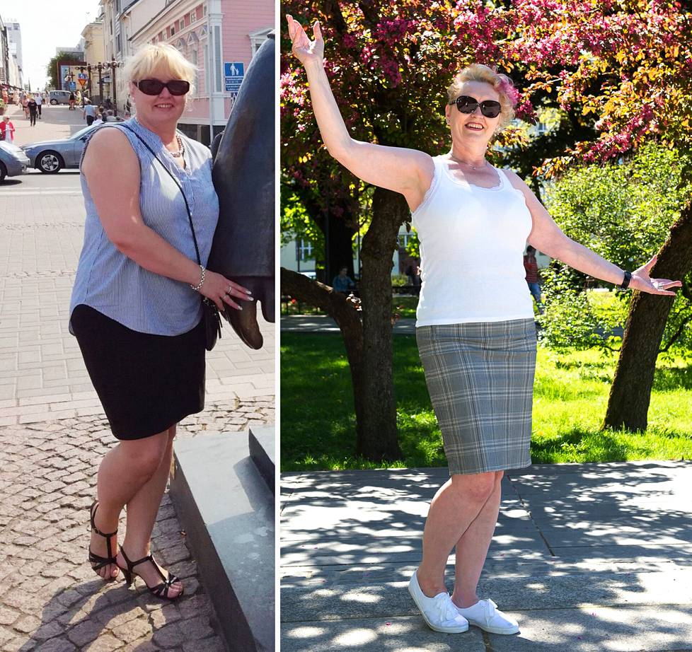 Anne-Maarit Huupponen ennen ja jälkeen Virossa tehdyn mahalaukun ohitusleikkauksen. 
