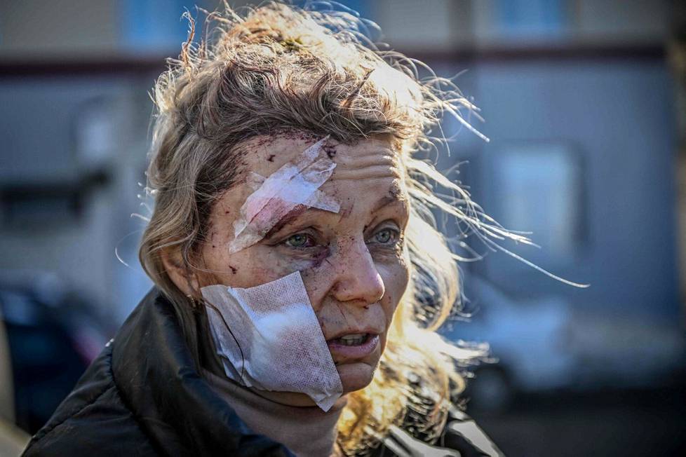 24. helmikuuta. 53-vuotias opettaja Helena seisoo sairaalan ulkopuolella Itä-Ukrainan Tšugivin kaupungin pommituksen jälkeen. Venäjä käynnisti hyökkäyksen Ukrainaan 24. helmikuuta 2022.