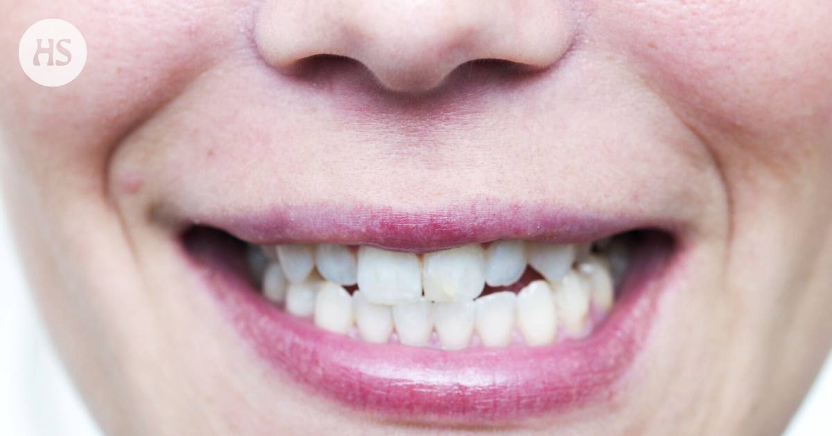 Scientists in Japan successfully develop new teeth