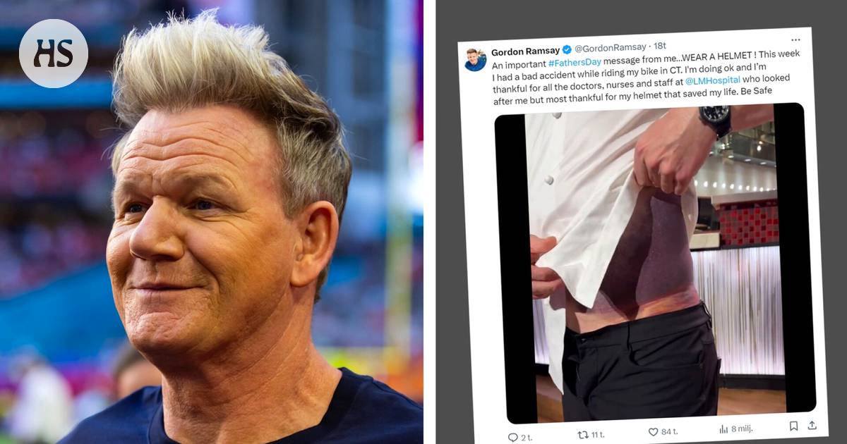 Top chef Gordon Ramsay received a bruise the size of his side in a bicycle accident: “It's been a rough week” – Culture