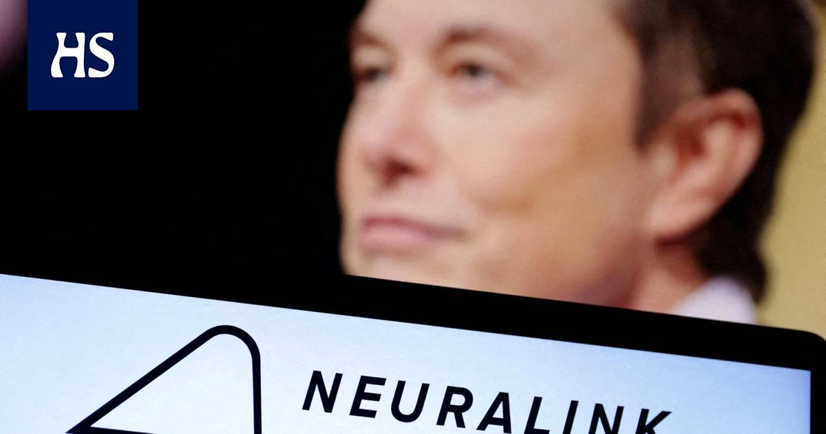 Elon Musk’s Neuralink says it has received permission to test its brain chip on humans – Science