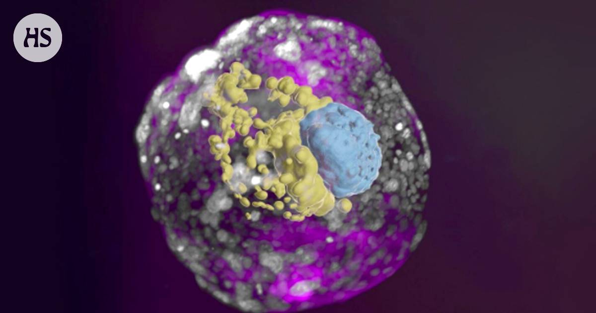 Human Embryo Model From Stem Cells The Observatorial 7528