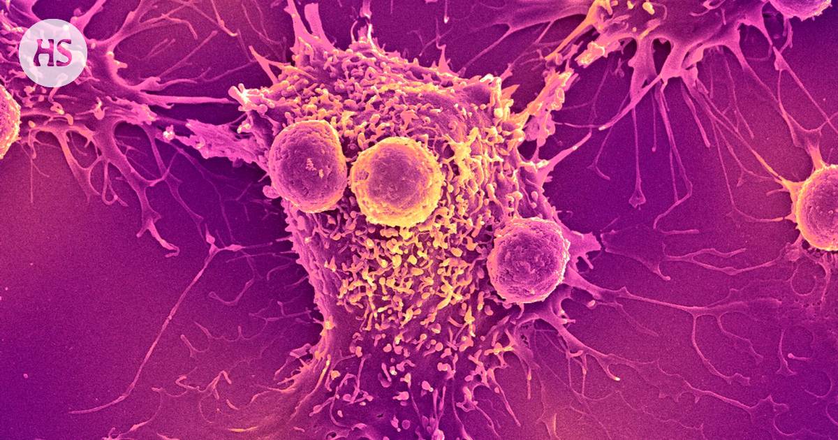 Kanserle mücadelede yeni yöntem: Kızılötesi ışık titreşimleri kullanılarak kanser hücreleri yok ediliyor