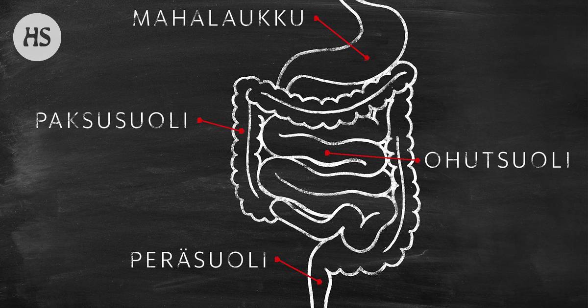 Hyvältä tuntuva vatsa ei aina voi hyvin, ja vehnäleipä jämähtää klöntiksi –  nämä seitsemän asiaa sinun tulee tietää, jos haluat välttää vatsavaivoja -  Hyvinvointi 